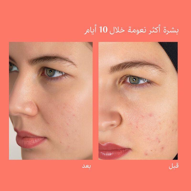 المنظف والمقشر اليومي بأحماض ألفا هيدروكسي والطحالب الحمراء image number null