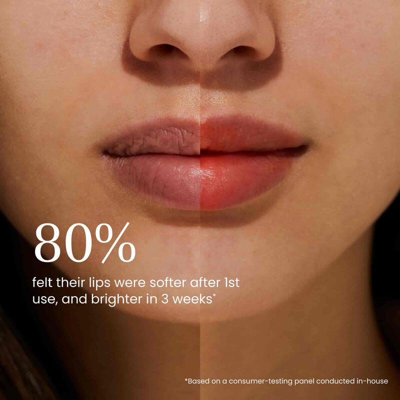 تنت الشفاه والخدود بالعكر الفاسي وحمض الهيالورونيك image number null