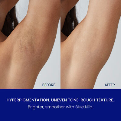 Brightening & Intimate Care Duo hover view