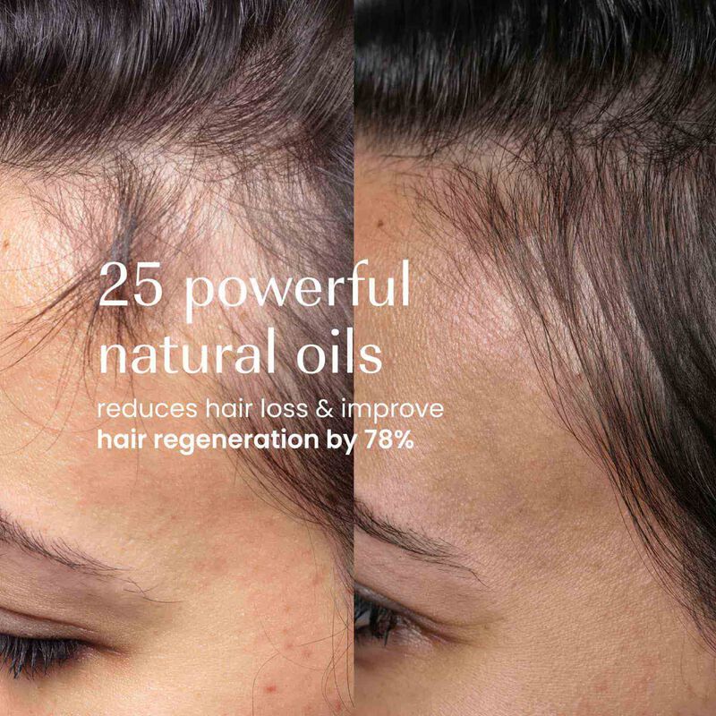 Densify Strengthening Hair Oil image number null
