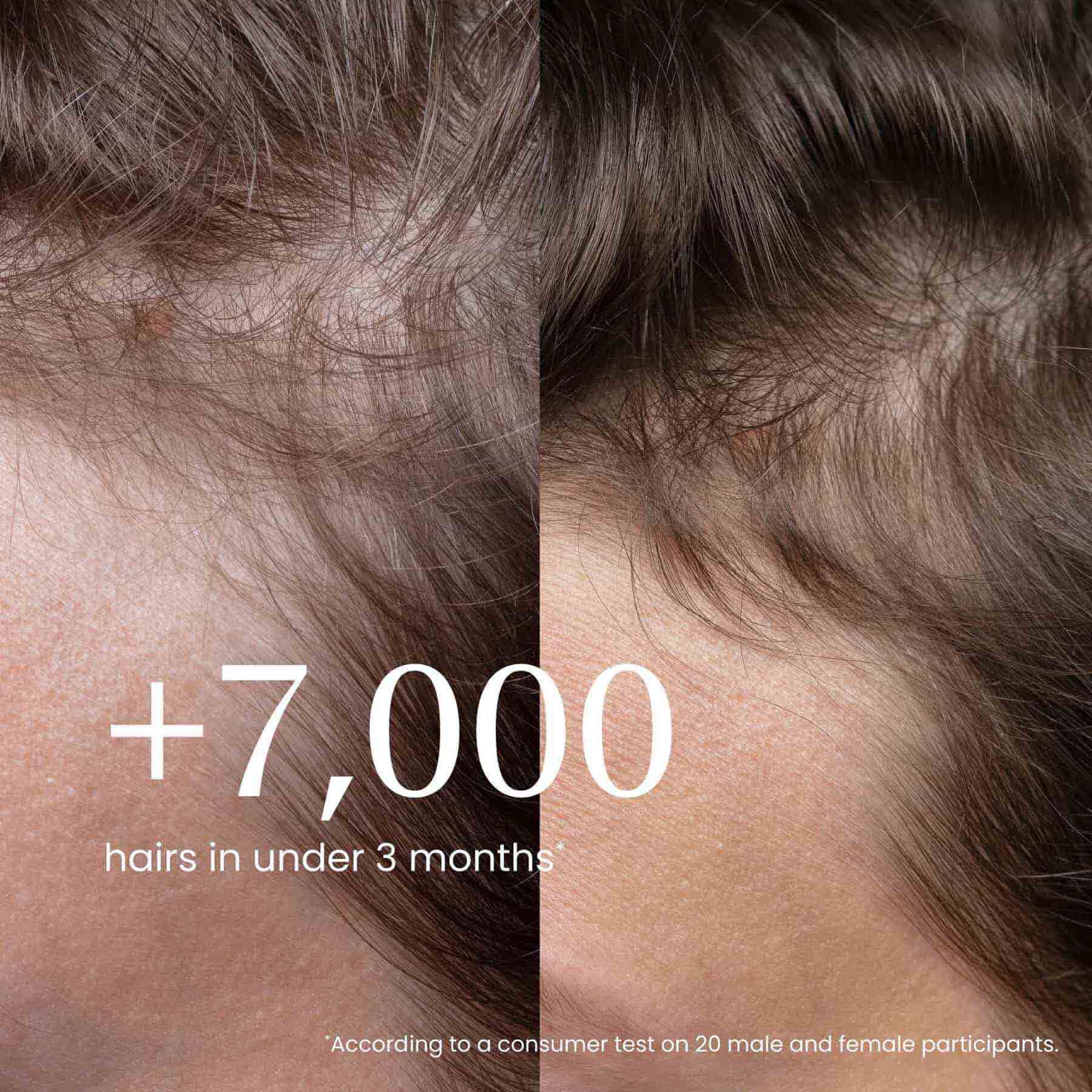 Shop Densify Strengthening Hair Ampoules Online | IZIL Beauty UAE