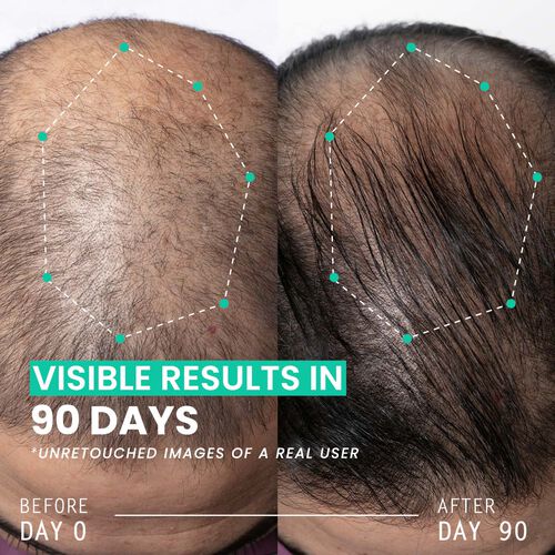 Hair Thickening Dual Action Routine - 90 Day Anti Hair Loss Solution
