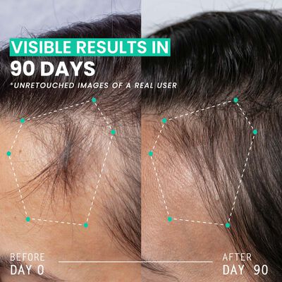 Hair Thickening Dual Action Routine - 90 Day Anti Hair Loss Solution image number null