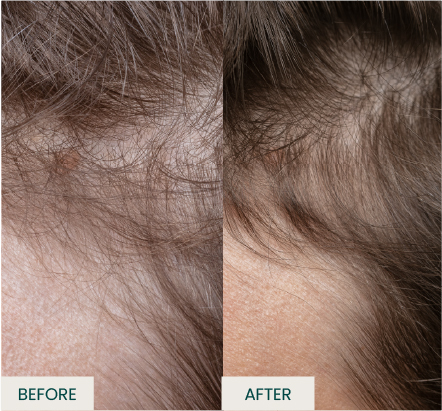90 Days Result