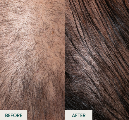 30 Days Result